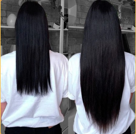 Antes e depois Ana Paula 34 anos - Kit SOS Crescimento